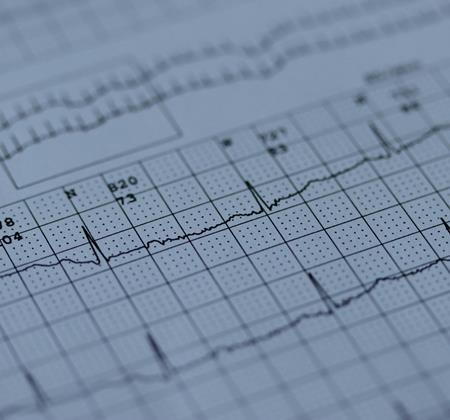 Advanced cardiac monitoring with Zio iRhythm